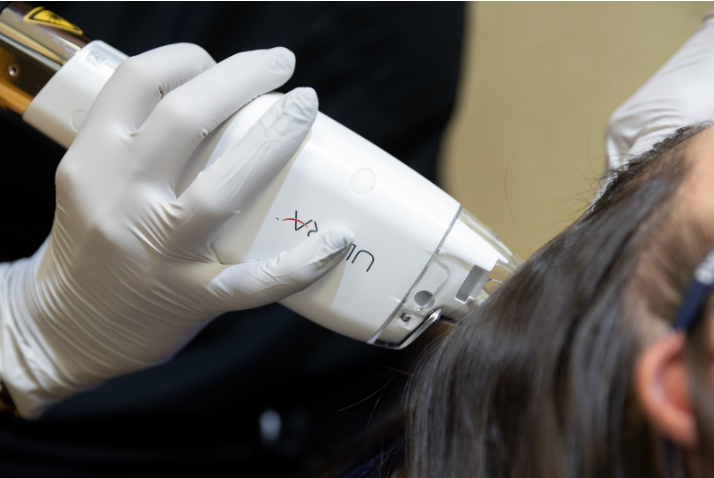 Keralase hair loss treatment